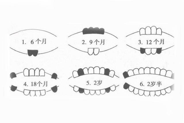 一岁四个月宝宝长几颗牙，牙齿生长规律与注意事项