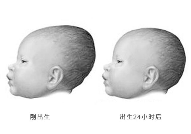 关于宝宝囟门闭合的正常时间，对8个月宝宝的观察与探讨